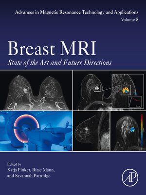 cover image of Breast MRI